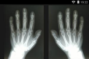 Radiografia de verdad تصوير الشاشة 2
