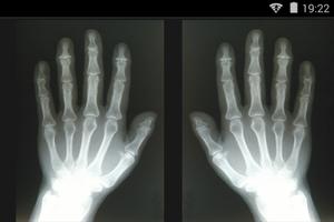 2 Schermata Xray