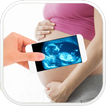 X-Ray Pregnant simulated