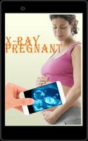 X-Ray Pregnant simulated Affiche