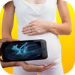 XRay Pregnant Ultrasound-prank