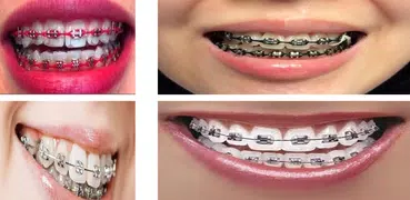 Design Braces 2018