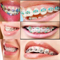 Design Braces 2018 APK download