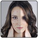 Acne Remover Zit remover Pimple Eraser APK