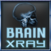 腦X射線掃描儀