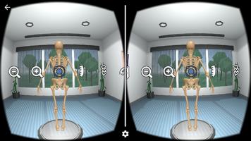 Scoliosis VR โปสเตอร์