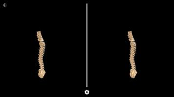 Scoliosis VR ภาพหน้าจอ 1