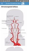 Stroke Guidelines 스크린샷 3