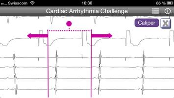 Cardiac Arrhythmia Challenge PRO Affiche