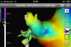 Cardiac Arrhythmia Challenge PRO syot layar 2