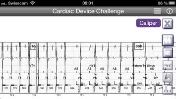 Cardiac Device Challenge PRO Affiche