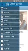 Česká gastroenterologická společnost Poster