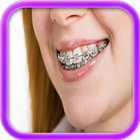 braces - brace teeth آئیکن