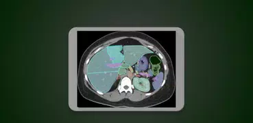 Radiology CT Anatomy