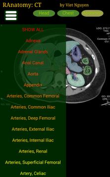 Radiology CT Anatomy screenshot 7