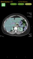 Radiology CT Anatomy постер