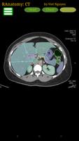 Radiology CT Anatomy Plakat