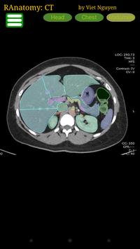 Radiology CT Anatomy poster