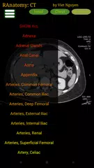 Скачать Radiology CT Anatomy APK