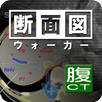 断面図ウォーカー腹部CT APK