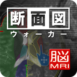 断面図ウォーカー脳MRI APK