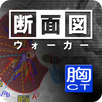 断面図ウォーカー胸部CT APK