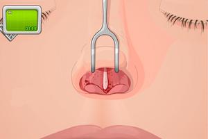 Operate Now: Nose Surgery syot layar 3
