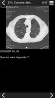 Cours TDM multicoupe du thorax 2 اسکرین شاٹ 1