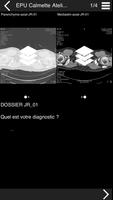 Cours TDM multicoupe du thorax 3 اسکرین شاٹ 1