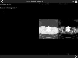 برنامه‌نما Cours TDM multicoupe du thorax 3 عکس از صفحه