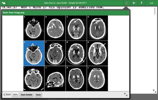 LiveLitigation 스크린샷 1