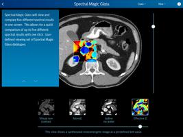 Philips IQon Spectral CT Funda syot layar 1