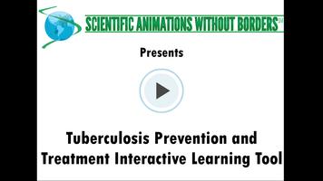 SAWBO TB Prevention Poster