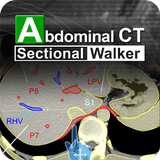 APK Abdominal CT Sectional Walker