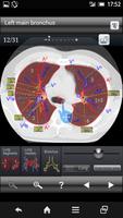 Chest CT Sectional Walker Poster