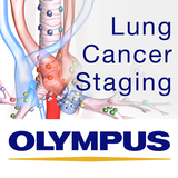 Lung Cancer Staging Table icône
