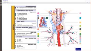 Lung Cancer Staging Table captura de pantalla 3