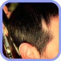 Queda de Cabelo