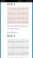 Diagnose ECG Ekran Görüntüsü 1