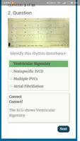Diagnose ECG screenshot 3
