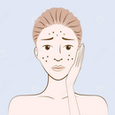 Get Rid of Acne Naturally APK