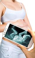 Ultrasound Scanner Affiche