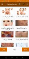 كيفية التخلص من حبوب البشرة الملصق