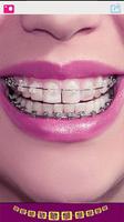 Cute Braces Teeth Editor скриншот 3