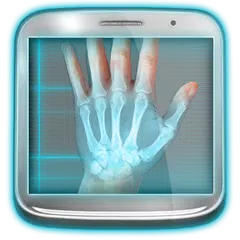 X-Ray Scanner: Augmented Prank
