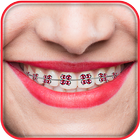 Braces Photo 아이콘