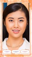 Braces Photo Cartaz