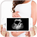Ultra Sound Scanner Prank APK