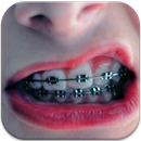 APK Sweet Braces Teeth Maker