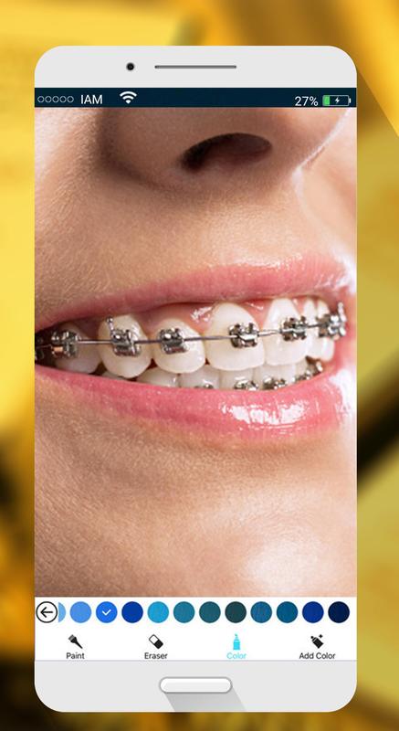 sweet braces teeth maker apk download free photography app for